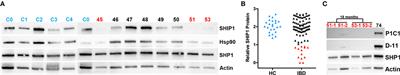 SHIP1 Deficiency in Inflammatory Bowel Disease Is Associated With Severe Crohn’s Disease and Peripheral T Cell Reduction